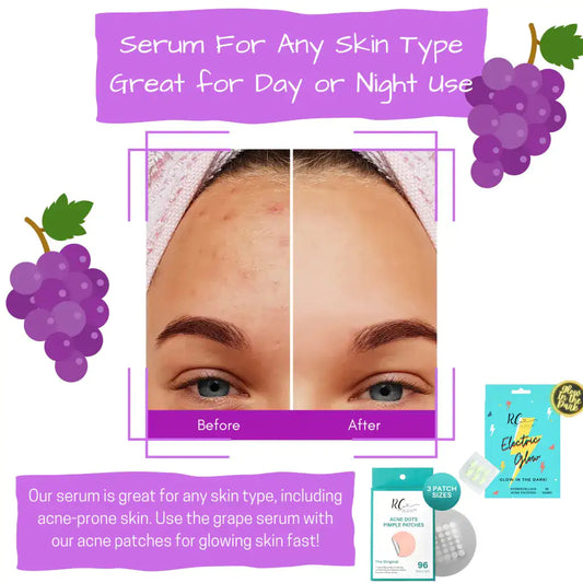 Hyaluronic Acid + Vitamin C Antioxidant Face Serum – Brightening, Hydrating & Anti-Aging | 1 fl oz